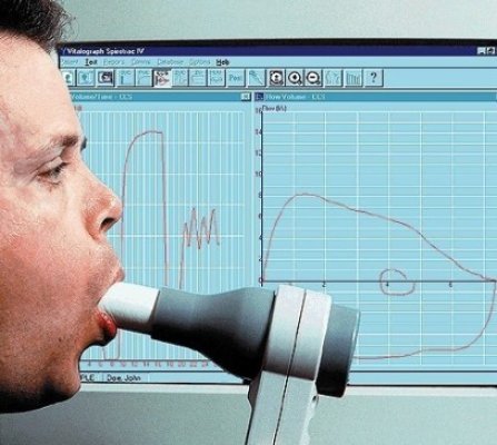 Spirometrii gratuite la Spitalul de Pneumoftiziologie